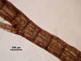 7 - Visione superficiale delle cellule corticali nella porzione distale di un asse eretto